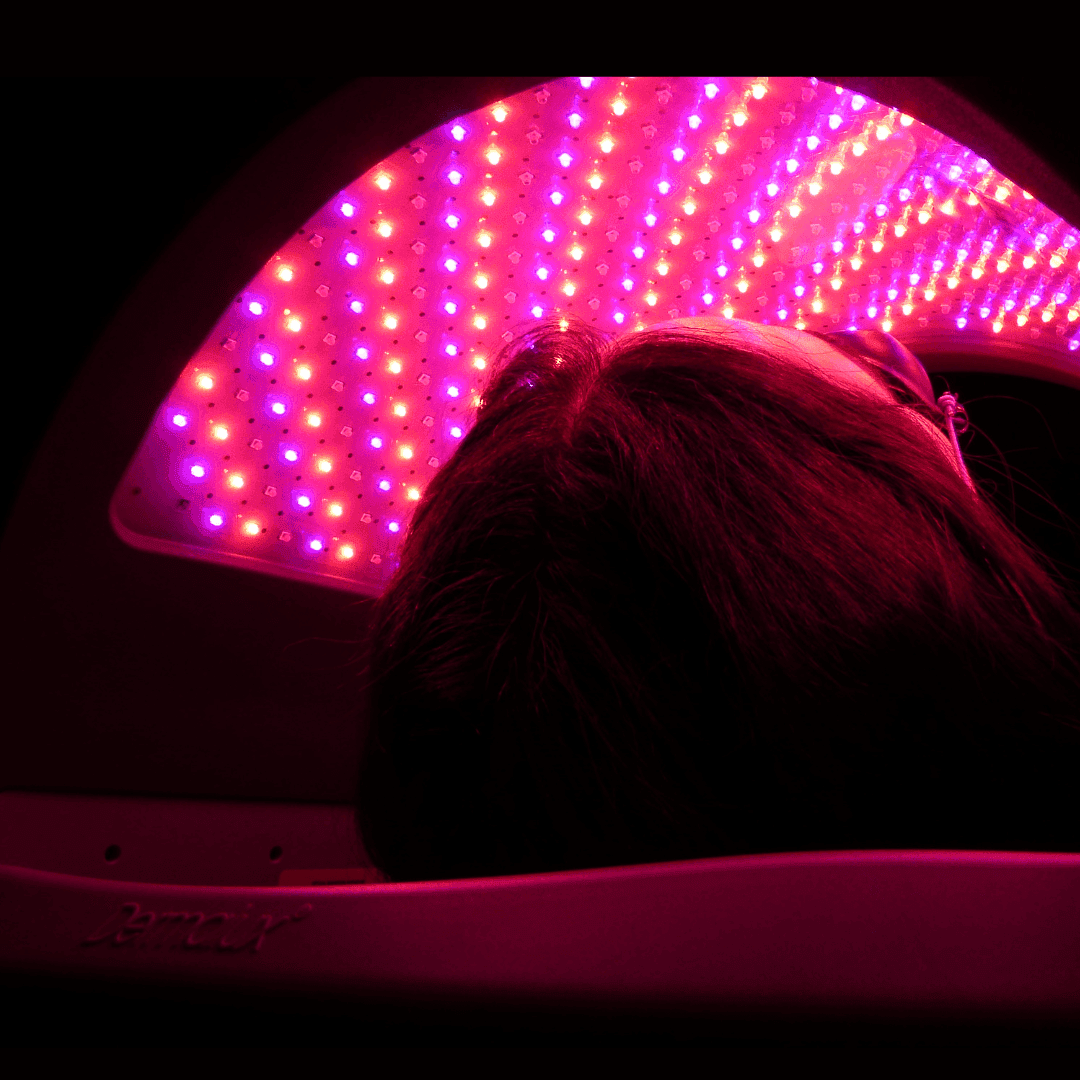 LED fototerapija - 2 tretmana